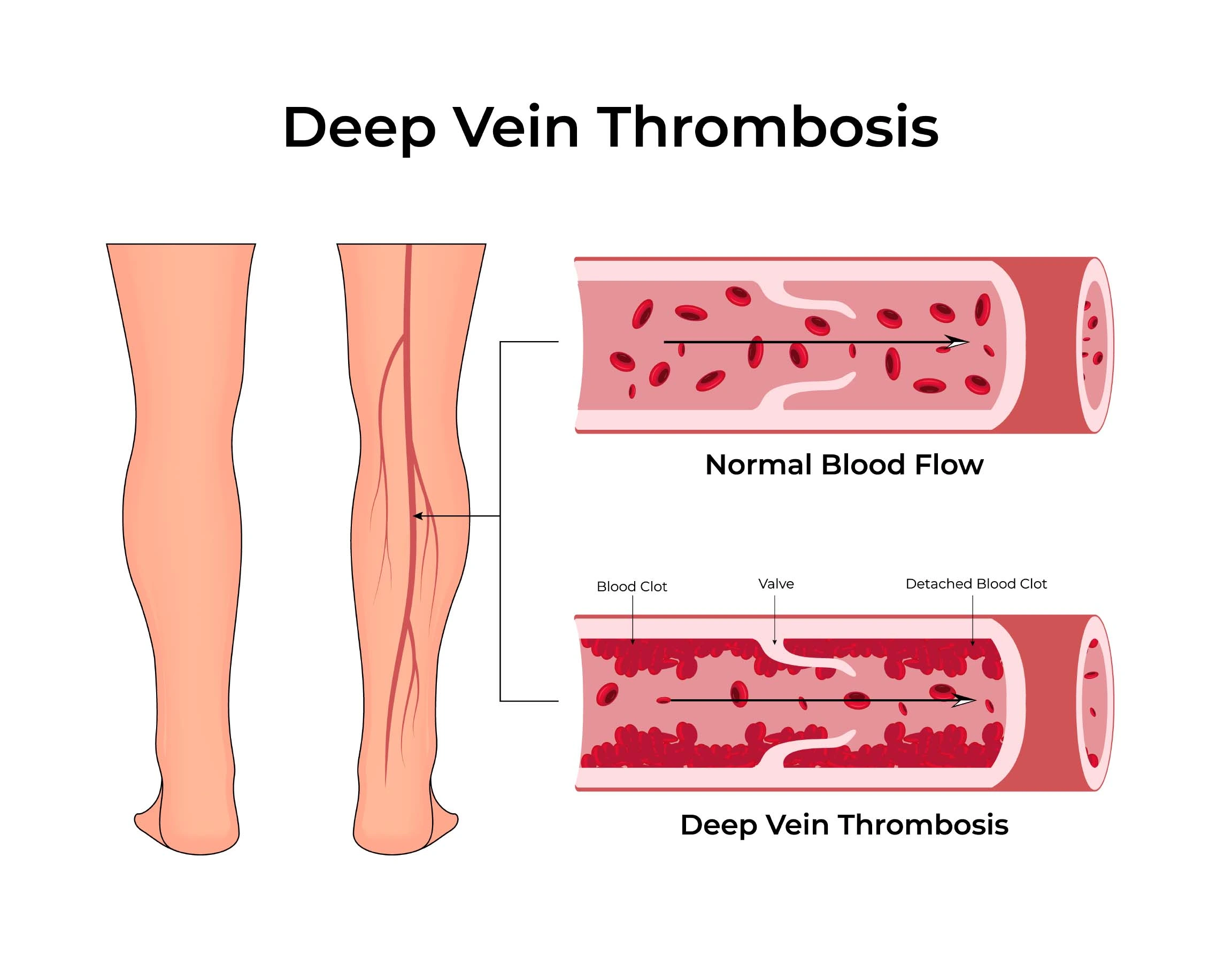 Doppler Ultrasound Diagnosis